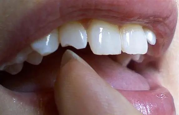 toof.jpg